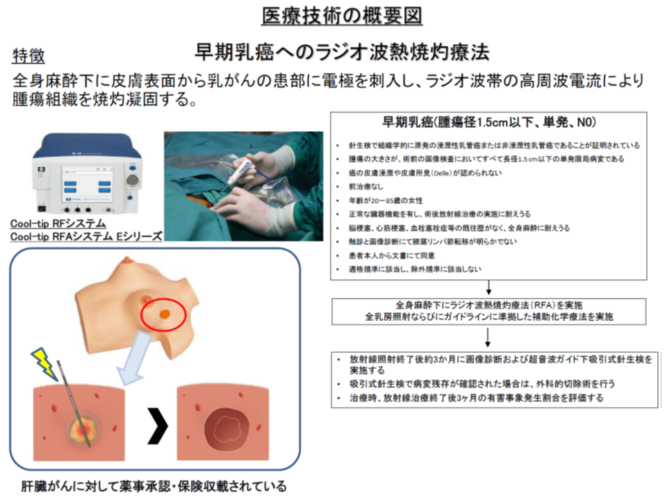 早期乳がんのラジオ波熱焼灼治療を患者申出療養に導入 再発リスク説明等が必要 患者申出療養評価会議 Gemmed データが拓く新時代医療